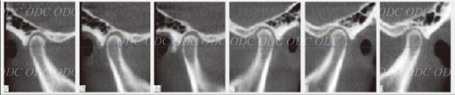 インプラント治療の流れ