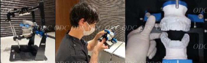 インプラント治療の流れ